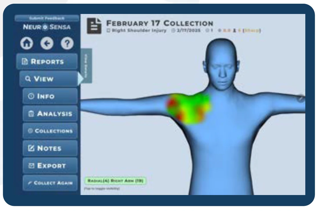 NeuroSensa software showing a right-shoulder pain collection on a 3D body